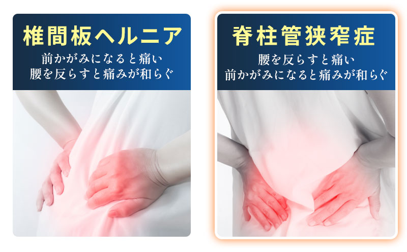 椎間板ヘルニアと脊柱管狭窄症の違い
